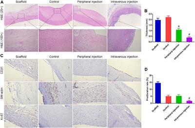 The Inhibitory Effect of Regulatory T Cells on the Intimal Hyperplasia of Tissue-Engineered Blood Vessels in Diabetic Pigs